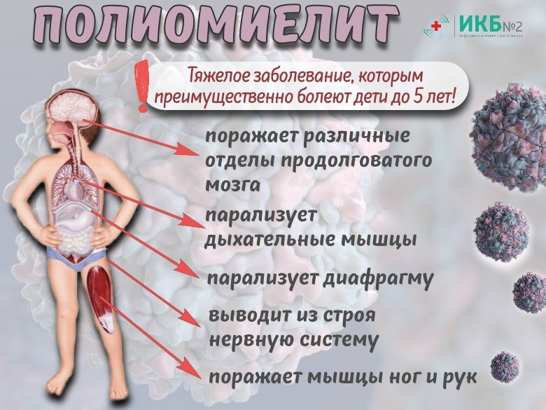 Полиомиелит.
